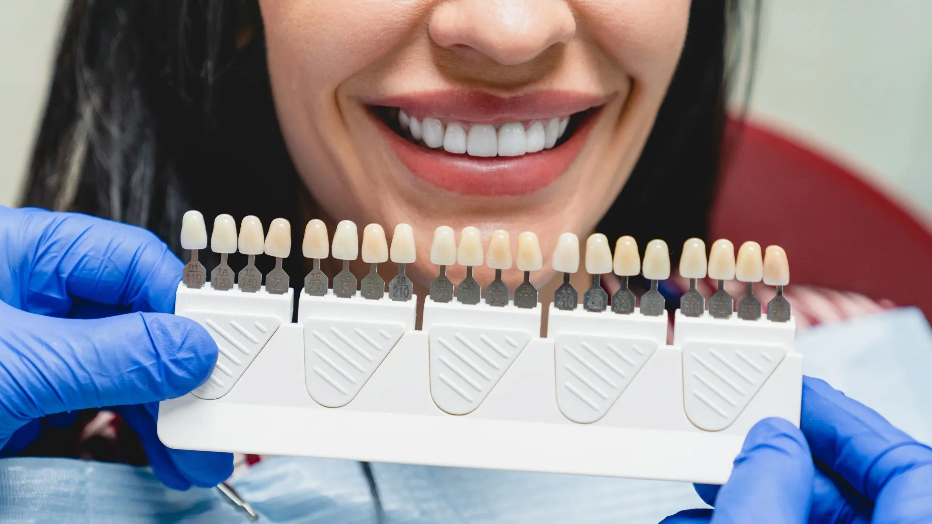 Can Veneers Fix Crooked Teeth
