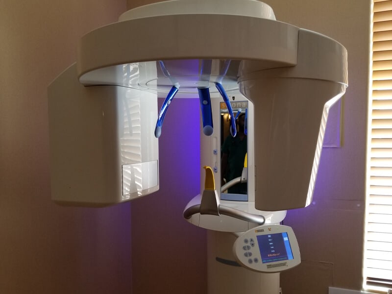 Cone Beam X-Ray Machine