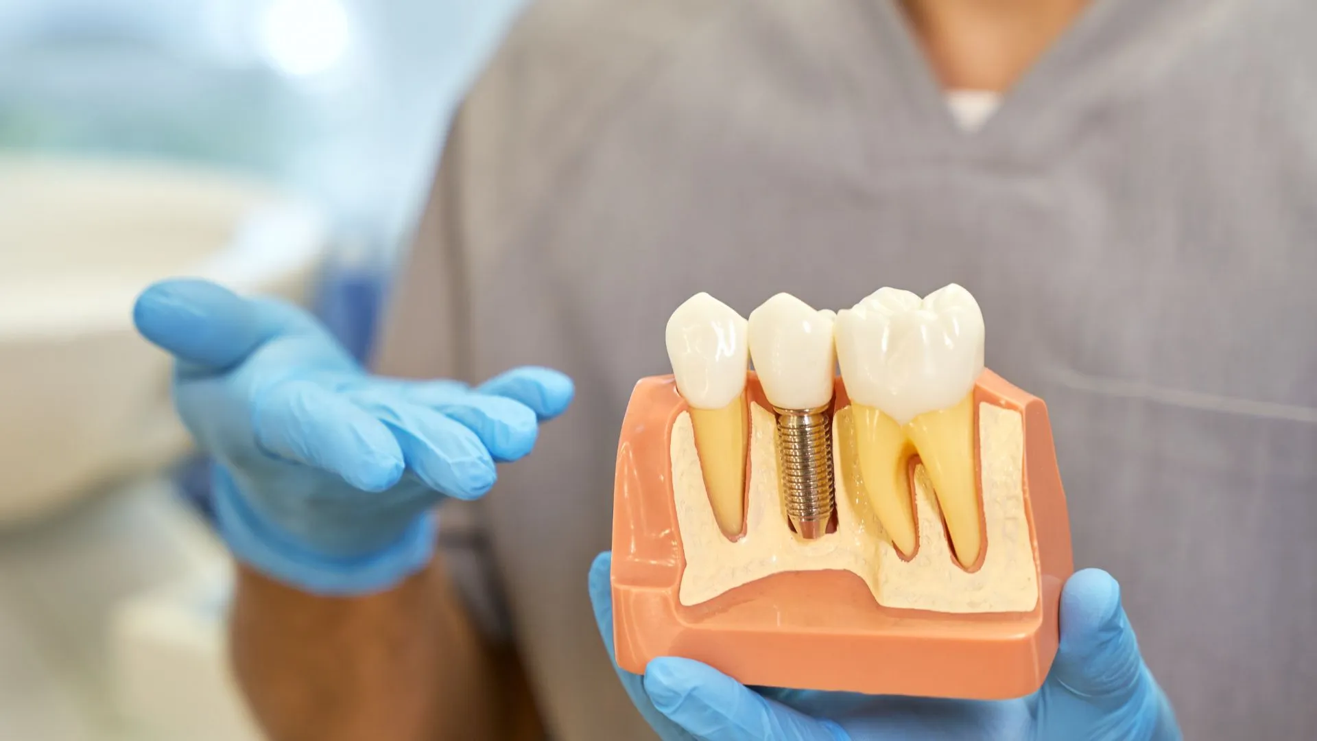Dental Implants and the Golden Era of Cosmetic Dentistry