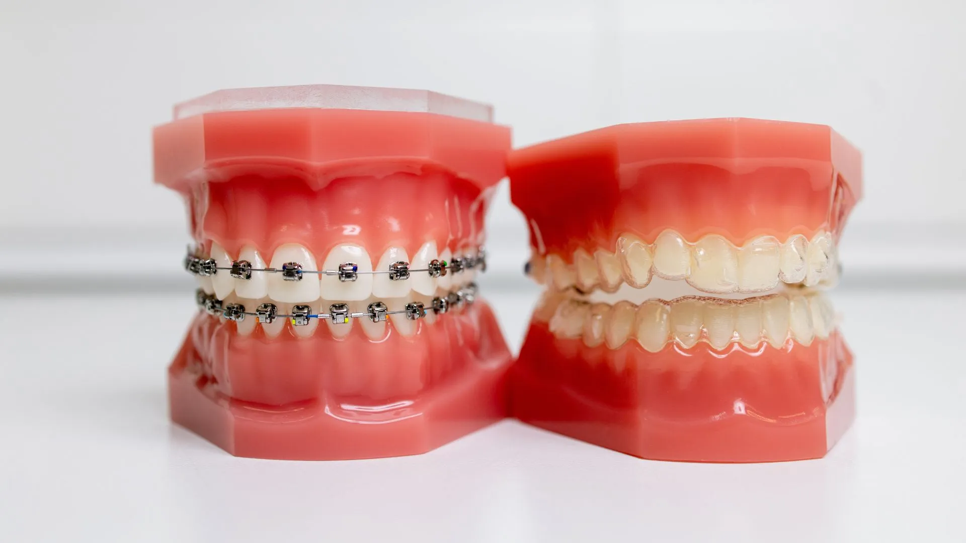Invisalign Is a Great Alternative to Traditional Braces