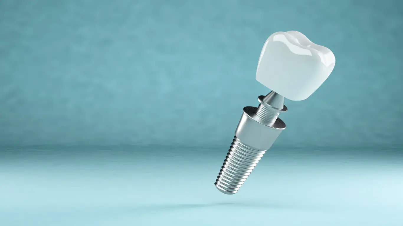 A dental implant in blue background