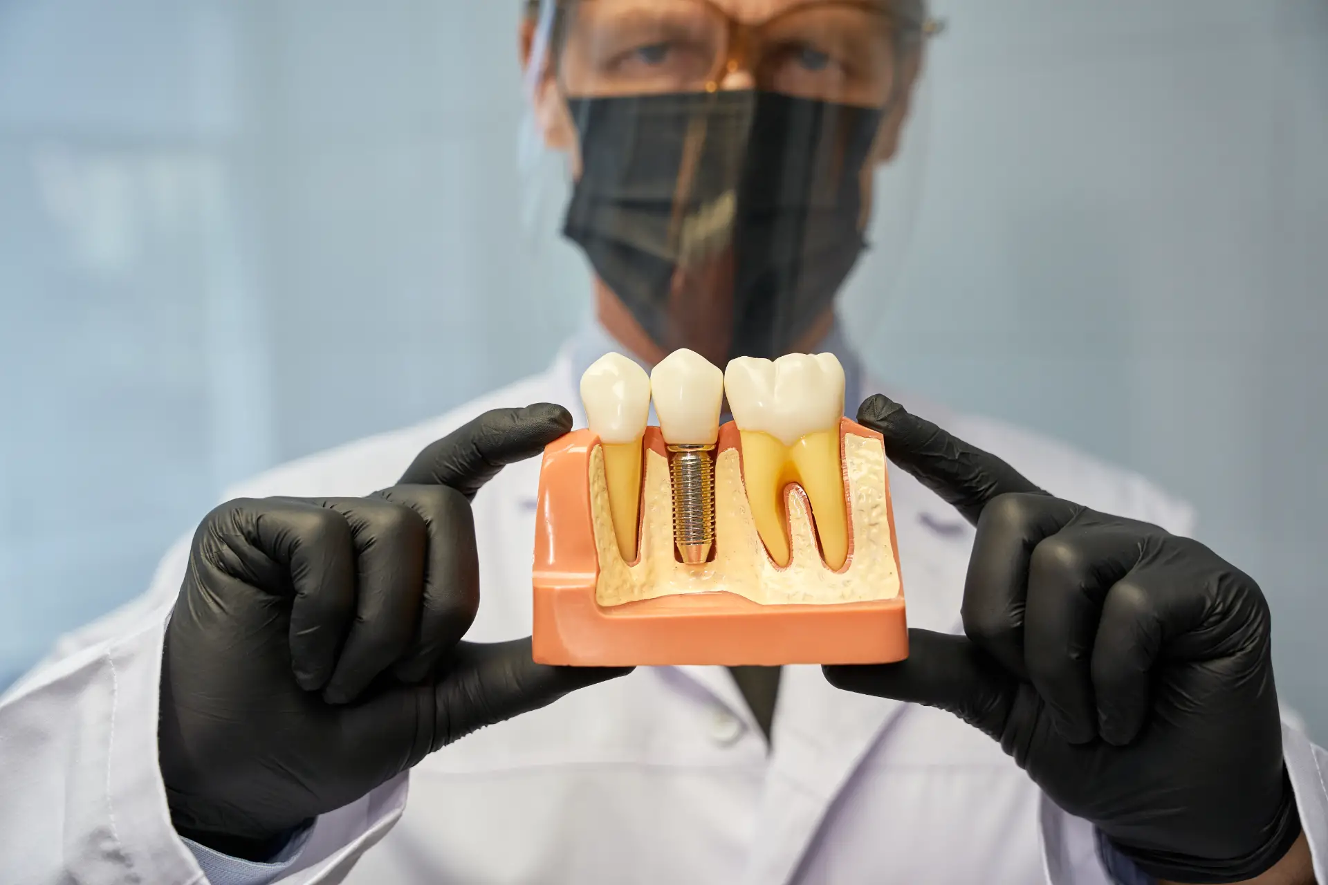 How Long Do Dental Implants Really Last